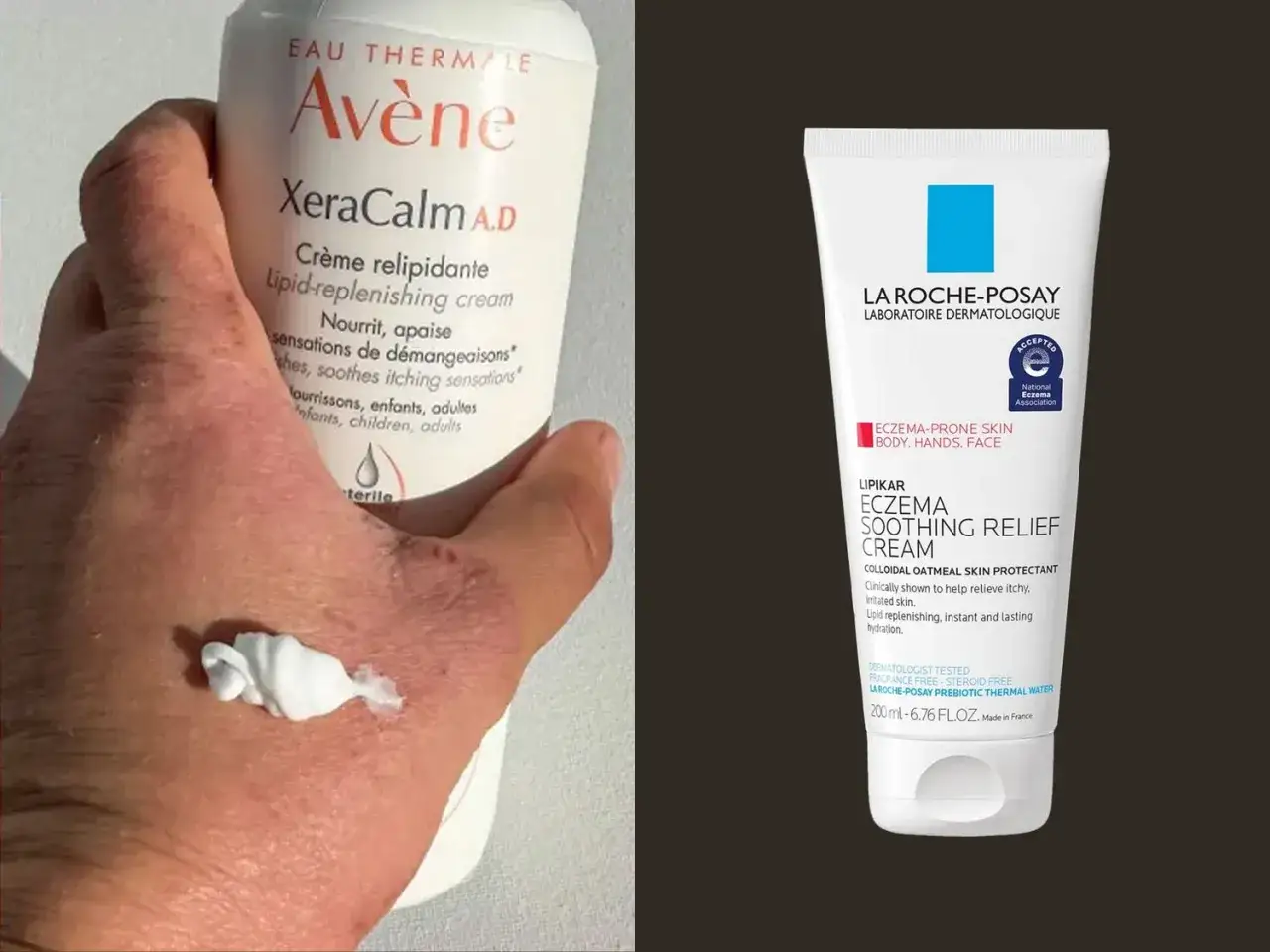 Dłoń z objawami atopii i kremy Avène XeraCalm AD oraz La Roche-Posay Lipikar, które pomagają łagodzić swędzenie i suchość skóry.